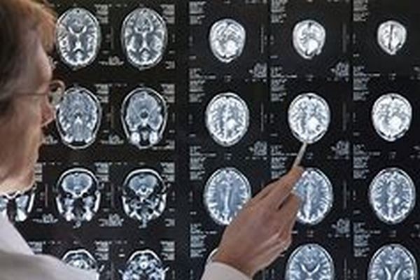 Meditation et Stress, les effets sur le cerveau.